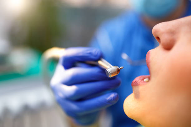 Dental Bonding in Ucon, ID